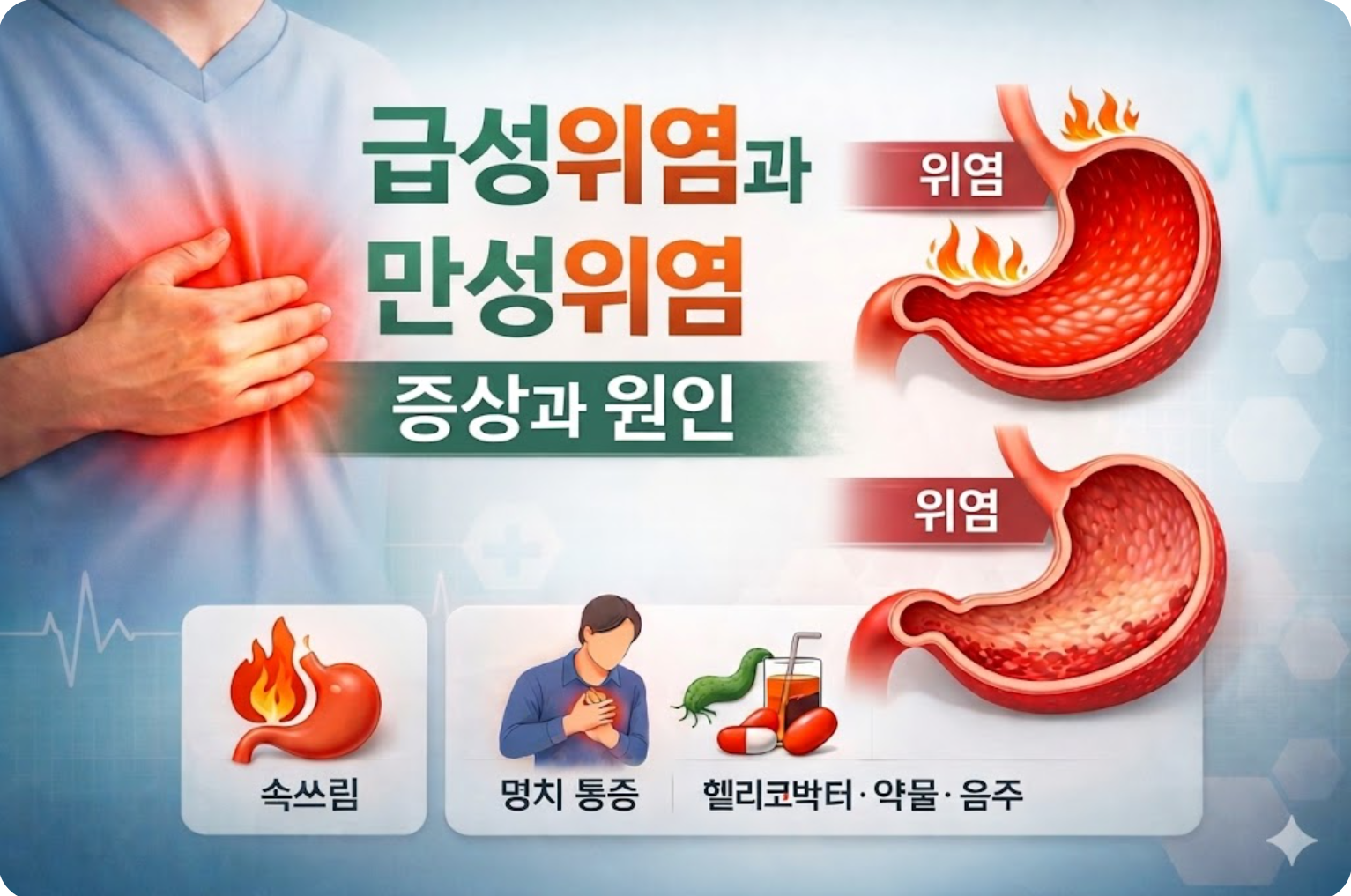 급성위염과 만성위염 증상과 원인