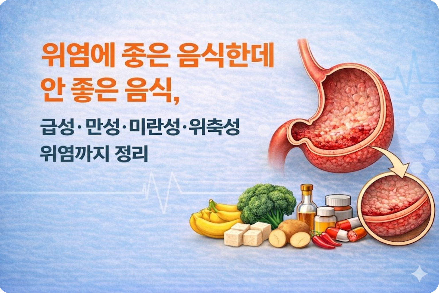 위염에 좋은 음식과 안좋은 음식, 급성·만성·미란성·위축성 위염까지 정리