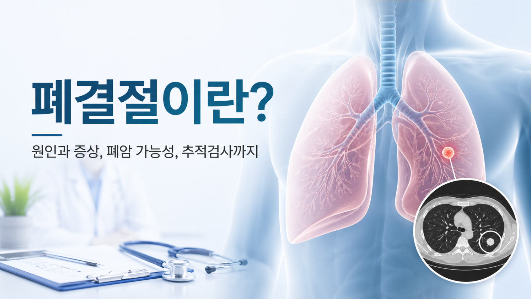 폐결절이란 원인과 증상, 폐암 가능성과 추적검사까지